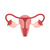 Оздоровительная программа при новообразованиях половой сферы женщин (кисты, миомы, фибриомы, эндометриоз)