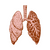 Оздоровча програма при алергічних захворюваннях дихальних шляхів (поліноз, бронхіальна астма, алергічний бронхіт)